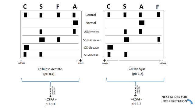 Answering Hemoglobin Electrophoresis Questions on the ASCP Exam